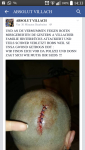 post-29347-0-49157300-1420378609_thumb.p