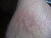 post-3146-1177841504_thumb.jpg
